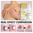 thumbnail image 3 of Brightening And Moisturizing Nipple Serum 30ml, 3 of 5