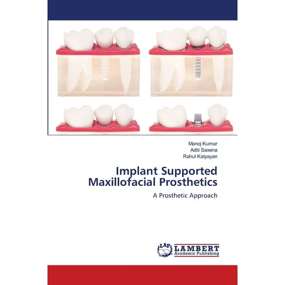 Implant Supported Maxillofacial Prosthetics (Paperback)