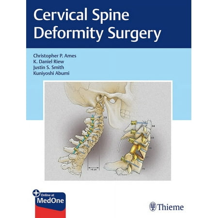 UPC: 9781626239012 | Cervical Spine Deformity Surgery (Hardcover)