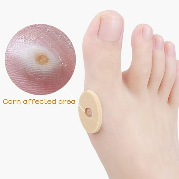 Dr scholl's shop ingrown toenail walmart