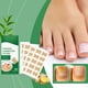 thumbnail image 5 of Parches Correctores para Uñas Encarnadas | Material Suave y Transpirable | Paquete de 50 Unidades, 5 of 7