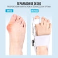 thumbnail image 2 of Corrector de Juanetes Ortopédico Ajustable de 1 pieza, Ferula Corrector Nocturno Juanetes para Mujer y Hombre (Blanco), 2 of 5