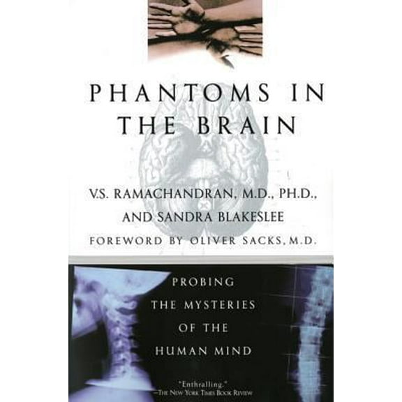 Pre-Owned Phantoms in the Brain (Paperback) 0688172172 9780688172176
