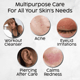 thumbnail image 4 of Daily Facial Spray for Sensitive Skin, HOCl Hypochlorous Acid Spray for Face - Body, Reduces Redness, Breakouts, Irritation, Eyelid Cleanser, Skin Repair, Scalp, Foot Care ( 4oz Pack of 1 ), 4 of 5