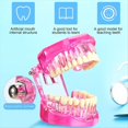 thumbnail image 3 of Modelo de Dientes con Enfermedades Tipodontos Dentales Modelo de Dientes de Implante con Dientes Removibles Demostración Patológica (Rosa, 2 Piezas), 3 of 5