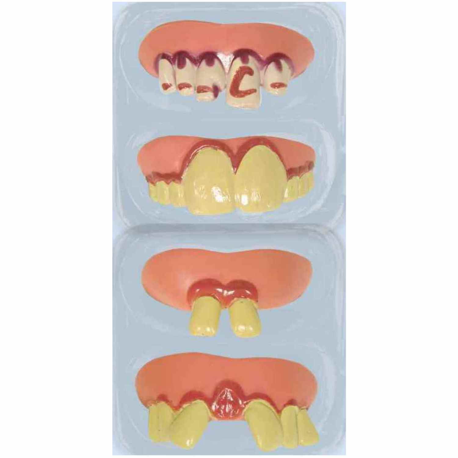 Funny Teeth Party Favors, 4 Pieces, by Way To Celebrate