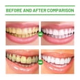 thumbnail image 4 of Care Toothpaste for Daily Cleaning Odors, Stains, and Stains, Mild Care for Teeth, Clean Care Toothpaste, 4 of 5