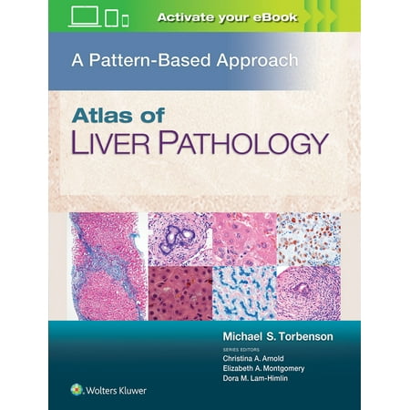 UPC: 9781496396976 | Atlas of Liver Pathology: A Pattern-Based Approach (Hardcover)