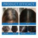 thumbnail image 5 of Rosemary Hair Growth Serum Roll On 30 ml - DHT-Blocking Scalp Serum Boosts Oxygen Flow, Reduces Hair Loss for Women & Men, 5 of 5