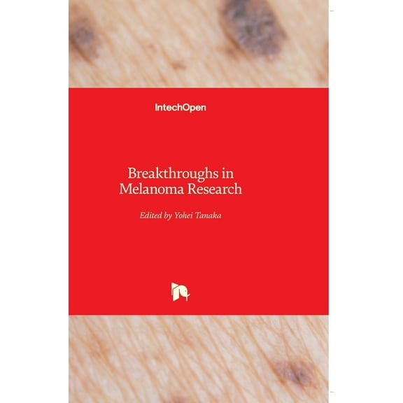 Breakthroughs in Melanoma Research (Hardcover)