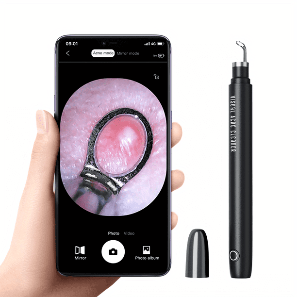 Kit d'Outils de Suppression de Points Noirs Rechargeable avec Caméra Ultra HD et Lumières - Obtenez des Résultats de Nettoyage des Pores Visibles sur les Téléphones Intelligents iPhone iPad et Android!