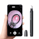 Kit d'Outils de Suppression de Points Noirs Rechargeable avec Caméra Ultra HD et Lumières - Obtenez des Résultats de Nettoyage des Pores Visibles sur les Téléphones Intelligents iPhone iPad et Android! – image 1 sur 7