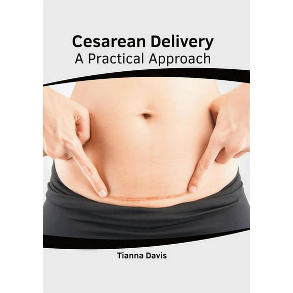 Cesarean Delivery: A Practical Approach, (Hardcover)