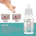 thumbnail image 4 of 1pc Fungal Nail Treatment Liquid Nail Repair Moisturizing Anti-bag Nursing Liqui, 4 of 5