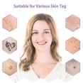thumbnail image 4 of Portable Beauty Gadget, Customer And Operator Glasses, Wireless Charging Concept, For Freckle And Birth Spot Removal, 4 of 5