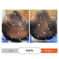 thumbnail image 4 of Set de champú y acondicionador DS LABORATORIES Revita contra la caída del cabello, 4 of 9