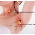 thumbnail image 4 of Anillo Magnético Terapéutico de Drenaje Linfático oso de fresa Electrónica, 4 of 4
