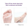 thumbnail image 5 of Foot Mask Exfoliating Dead Exfoliating Calluses And Heel Cuticles Foot Mask Care 6ml Mascarilla para pies - Foot Masks, 5 of 7