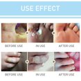 thumbnail image 3 of Foot Corn Calluses Removal Plaster 24pcs Patches Thorn Remover Patch, 3 of 12