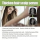thumbnail image 4 of Dense Hair Scalp Essence Anti-fall Hair Care Moisturizing Repair Scalp Strong Hair Thick Massage, 4 of 5