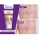 thumbnail image 3 of Crema Para Varices Efecto Calmante 160 grs. Gorecki Gorecki Crema Para Varices, 3 of 3