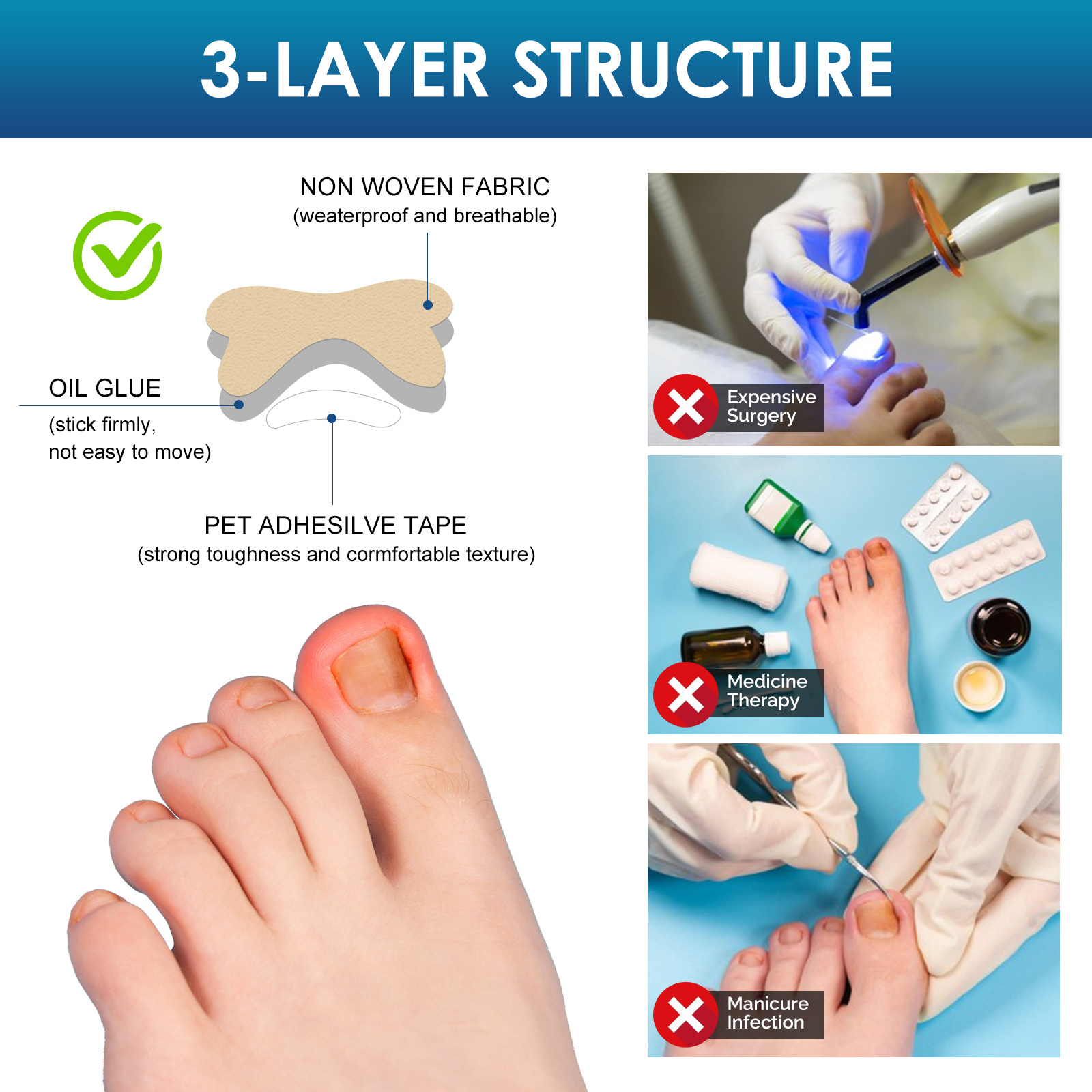 Ingrown Toenail Treatment, Ingrown Toenail Corrector Strips, Professional Safe Efficient, for Paronychia Caused by Ingrown Toenail, 50 Pcs, with professional pedicure tools Ingrown Toenail Removal Kit 100 PCS Professional Toe Nail Treatment Tool Ingrown Toenail Corrector Toenail Corrector Patch and Toe Protectors for