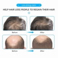 thumbnail image 3 of Wearable Red Light Cap for Scalp Care, Hands-Free Wellness Device with Timed Sessions for At-Home Relaxation, USB Rechargeable, for Men and Women, 3 of 5
