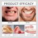 thumbnail image 4 of Juego de prótesis dentales completas Perfect Fit para hombres y mujeres, prótesis dentales superiores e inferiores., 4 of 5