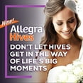 Allegra Hives Antihistamine Tablets (30Count), NonDrowsy, 24HR Itch