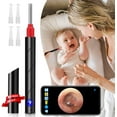 thumbnail image 1 of Ear Wax Remover,Wireless Otoscope Earwax Removal Tool 1080P HD WiFi Ear Endoscope with LED Light,3.5mm Visual Ear Scope Camera Safe Ear Pick Ear Cleaning Endocsope Kit for Adults Kids & Pets, 1 of 7