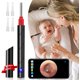 thumbnail image 1 of Removedor de cera para oídos, otoscopio inalámbrico, herramienta de eliminación de cera para oídos, endoscopio de oído WiFi HD 1080P con luz LED, cámara visual de alcance de oído de 3,5 mm, kit de, 1 of 7