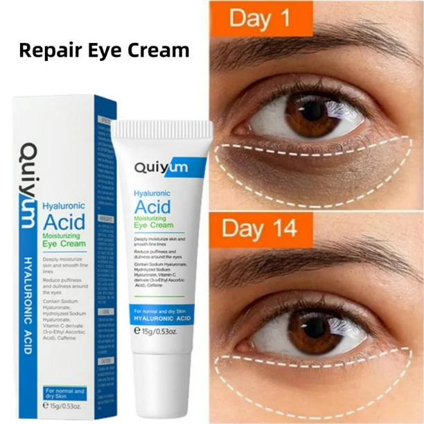 Crema para eliminar ojeras y ojeras Suero antienvejecimiento con retinol Elimina bolsas y bolsas debajo de los ojos Atenúa arrugas y líneas finas Reafirma el contorno de ojos