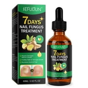 7-Day Toenail Fungus Treatment – Extra Strength Nail Repair for Discoloration & Health (60 ML)