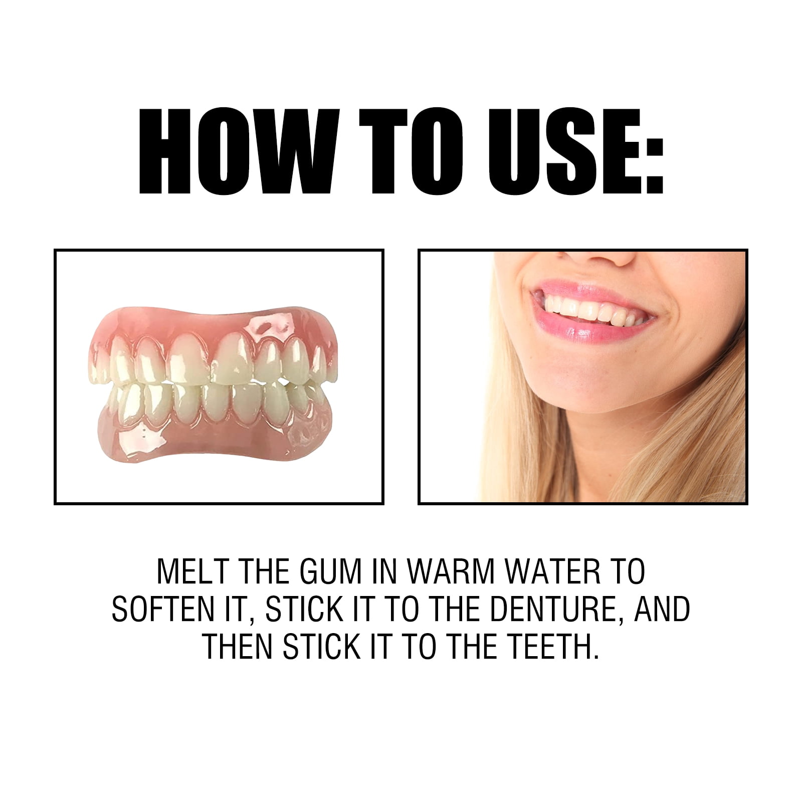 Alvantor Soft Denture Reline Kit with Interdental Fillings and Braces for Upper Lower Teeth
