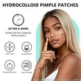 thumbnail image 3 of Pimple Patches for Face, Hydrocolloid Acne Patches, Star Zit Covers, Black Superstar Patches Spot Stickers, 102 Count | 4 Sizes (8mm/9mm/11mm/14mm), 3 of 7