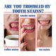 thumbnail image 3 of 120g Sp-6 Probiotics Brightening White Toothpaste Tooth, 3 of 5