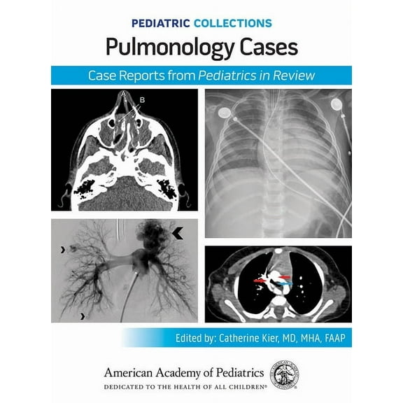 Pediatric Collections Pediatric Collections: Pulmonology Cases: Case Reports from Pediatrics in Review, (Paperback)
