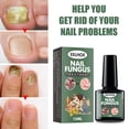 thumbnail image 4 of Líquido para eliminar hongos en las uñas de los pies 15 ml esencia para uñas hongos en las uñas de los pies cuidado de los pies y las manos, 4 of 9