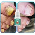 thumbnail image 1 of Tratamiento de uñas AFeng 10ml, 1 of 5