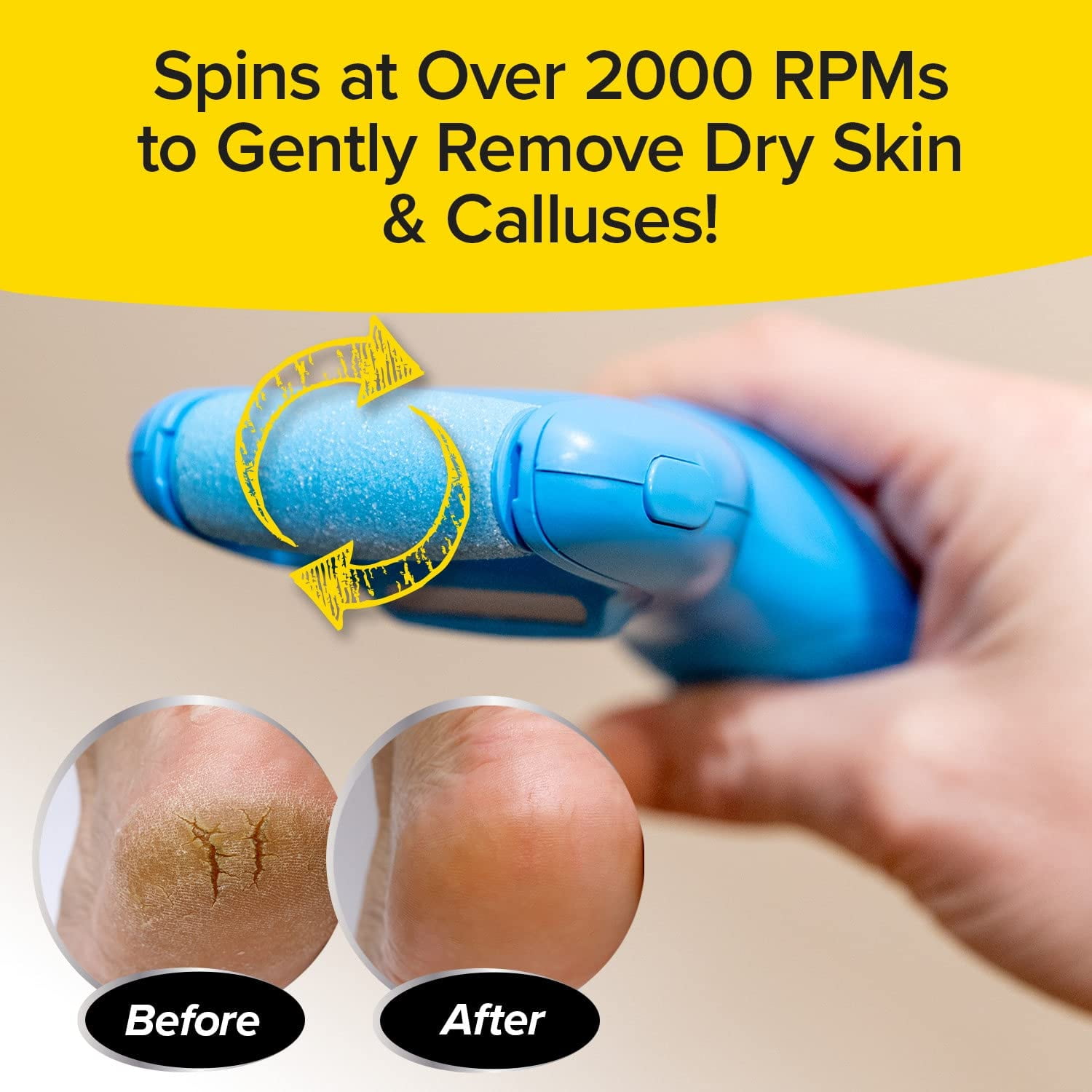 PedEgg Power Cordless Motorized Callus Remover w/ Bright LED Light As Seen On TV, Quickly Removes Calluses