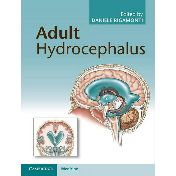Adult Hydrocephalus, (Hardcover)