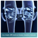 thumbnail image 5 of "Masajeador Pies Electricos Para Regalos Lab.G Azul ", 5 of 5