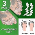 thumbnail image 3 of Yogamedic Silicone Toe Separators for Overlapping Toes, Bunion Relief and Alignment, 6-Pack, BPA-Free, One Size, Comfortable Stretching and Relaxation, 3 of 5