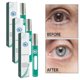 thumbnail image 1 of Rodillo de masaje ocular para el alivio de la fatiga Paquete de 3 - Tratamiento nutritivo debajo de los ojos de 8 ml con tecnología de acupuntura - Masajeador de metal refrescante para ojos secos y, 1 of 4