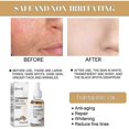 thumbnail image 2 of Turmeric Essence Remove Dark Spots Repair Anti-aging Fade Fine Lines And Wrinkles Skin Moisturizing Moisturizing Essence, 2 of 5