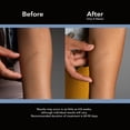 thumbnail image 4 of ScarAway ScarAway® Silicone Scar Sheets shrink, flatten and fade scars, 4 Reusable Sheets, 2 Month Supply, 4 of 8