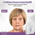 thumbnail image 2 of Sérum Eye Lift y Eye Tuck Beverly Hills V-Lift 30 ml, 2 of 8