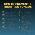 FungiNail AntiFungal Liquid Kills Fungus That Can Lead to Nail & Athlete's Foot, Tolnaftate