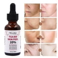 thumbnail image 1 of 30ml Tca D2t1 20% ácido tricloroacético antiarrugas suero para la piel cuidado Facial cuidado de la piel, 1 of 3