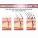 thumbnail image 5 of suitable for Hair Growth Spray Anti Hair Loss Nourishing Roots Hair Care Essences for Hair Care, 5 of 5
